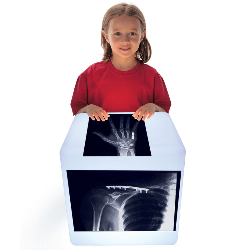 Fixed Bones X-rays