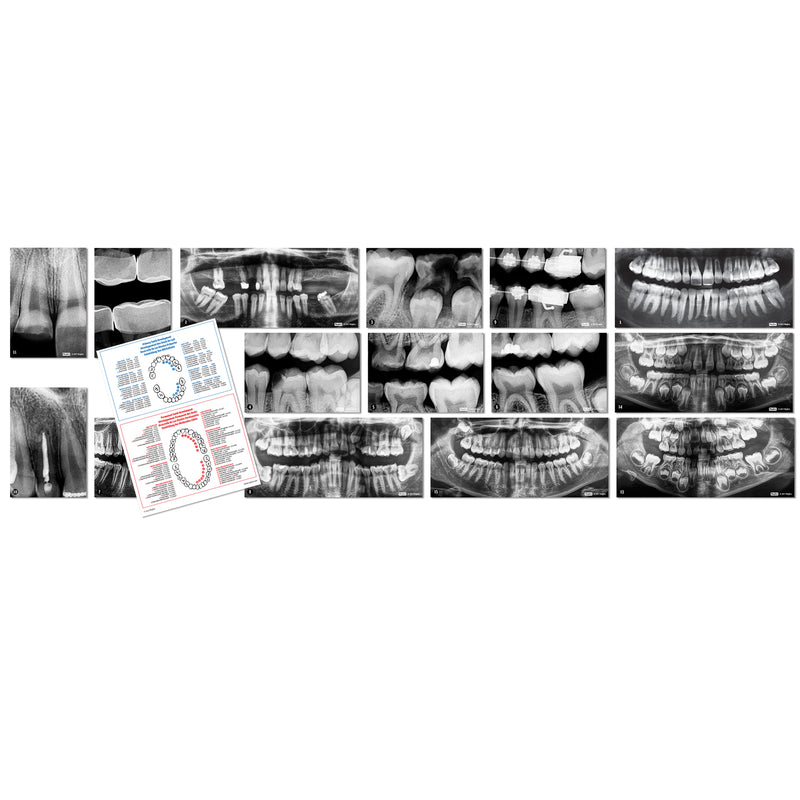 Dental Xrays