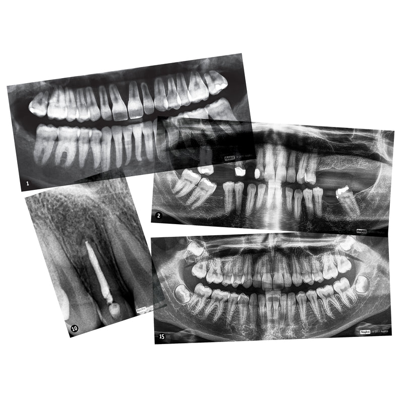 Dental Xrays